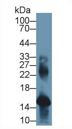 Western blot - Anti-Hemoglobin antibody (AB231584)