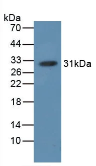 Western blot - Anti-Hemoglobin antibody (AB231584)