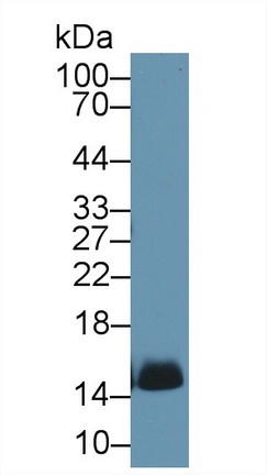Western blot - Anti-Hemoglobin antibody (AB231732), expandable thumbnail