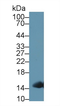Western blot - Anti-Hemoglobin antibody (AB231732), expandable thumbnail