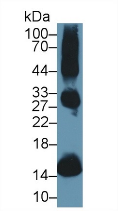 Western blot - Anti-Hemoglobin antibody (AB231732), expandable thumbnail