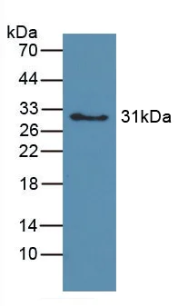 Western blot - Anti-Hemoglobin antibody (AB231732)