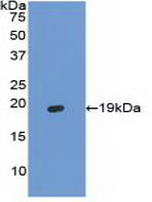 Western blot - Anti-Hemoglobin antibody (AB231803), expandable thumbnail