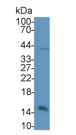 Western blot - Anti-Hemoglobin antibody (AB231803)
