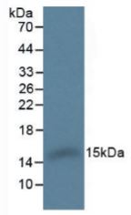 Western blot - Anti-Hemoglobin antibody (AB231803), expandable thumbnail