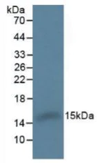 Western blot - Anti-Hemoglobin antibody (AB231803)