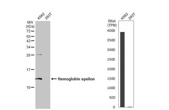 Western blot - Anti-Hemoglobin epsilon antibody [HL2458] (AB317230)