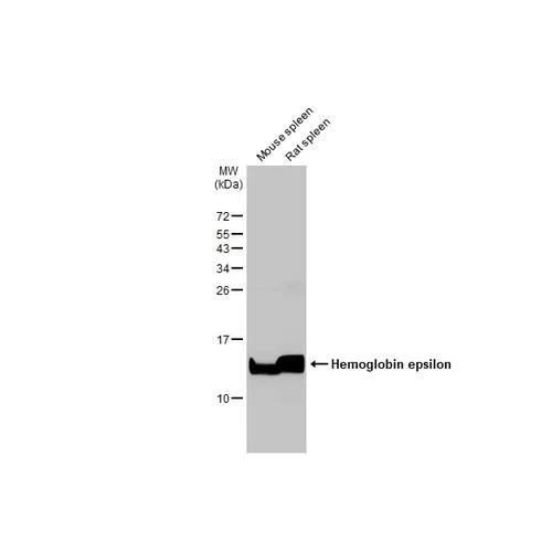 Western blot - Anti-Hemoglobin epsilon antibody [HL2458] (AB317230)