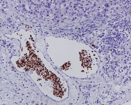 Immunohistochemistry (Formalin/PFA-fixed paraffin-embedded sections) - Anti-Hemoglobin subunit alpha antibody [EPR3608] (AB92492)