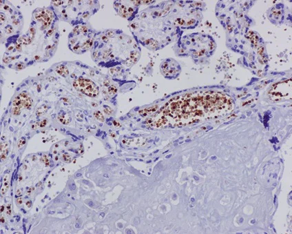 Immunohistochemistry (Formalin/PFA-fixed paraffin-embedded sections) - Anti-Hemoglobin subunit alpha antibody [EPR3608] (AB92492)