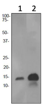 Western blot - Anti-Hemoglobin subunit alpha antibody [EPR3608] (AB92492)
