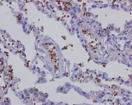 Immunohistochemistry (Formalin/PFA-fixed paraffin-embedded sections) - Anti-Hemoglobin subunit alpha antibody [EPR3608] - BSA and Azide free (AB174536)
