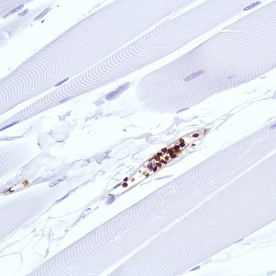 Immunohistochemistry (Formalin/PFA-fixed paraffin-embedded sections) - Anti-Hemoglobin subunit alpha antibody [SP212] (AB227671)