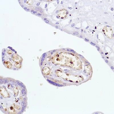 Immunohistochemistry (Formalin/PFA-fixed paraffin-embedded sections) - Anti-Hemoglobin subunit alpha antibody [SP212] (AB227671)