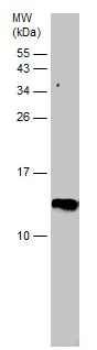 Western blot - Anti-Hemoglobin subunit beta antibody (AB227552)