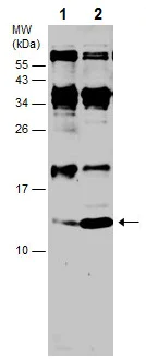 Western blot - Anti-Hemoglobin subunit beta antibody (AB227552)