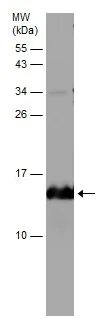 Western blot - Anti-Hemoglobin subunit beta antibody (AB227552)