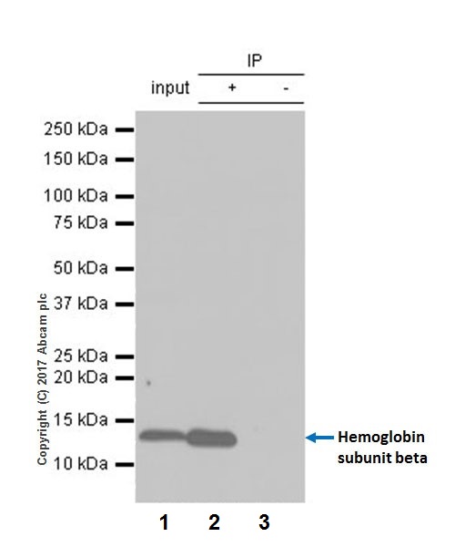 Immunoprecipitation - Anti-Hemoglobin subunit beta antibody [EPR20614] (AB214049), expandable thumbnail