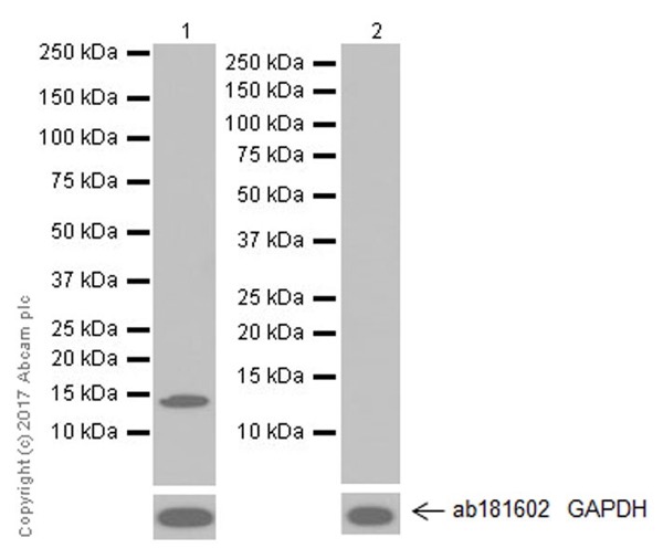 Western blot - Anti-Hemoglobin subunit beta antibody [EPR20614] (AB214049), expandable thumbnail