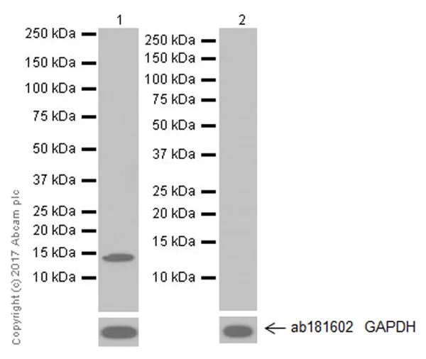 Western blot - Anti-Hemoglobin subunit beta antibody [EPR20614] (AB214049)