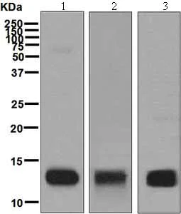 Western blot - Anti-Hemoglobin subunit beta + Hemoglobin subunit delta antibody [EPR8322(B)] (AB131225)