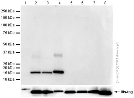 Western blot - Anti-Hemoglobin subunit beta + Hemoglobin subunit delta antibody [EPR8322(B)] (AB131225)