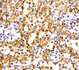 Immunohistochemistry (Formalin/PFA-fixed paraffin-embedded sections) - Anti-Hemoglobin subunit beta + Hemoglobin subunit delta antibody [EPR8322(B)] - BSA and Azide free (AB248384)