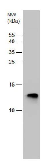 Western blot - Anti-Hemoglobin subunit zeta antibody (AB228651)