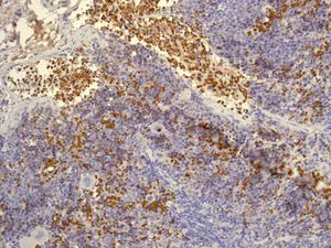 Immunohistochemistry (Formalin/PFA-fixed paraffin-embedded sections) - Anti-Hemoglobin subunit zeta + Hemoglobin subunit alpha antibody [EP3607] (AB109444)