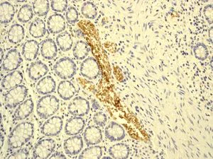Immunohistochemistry (Formalin/PFA-fixed paraffin-embedded sections) - Anti-Hemoglobin subunit zeta + Hemoglobin subunit alpha antibody [EP3607] (AB109444)