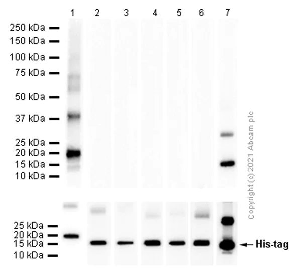 Western blot - Anti-Hemoglobin subunit zeta + Hemoglobin subunit alpha antibody [EP3607] (AB109444)