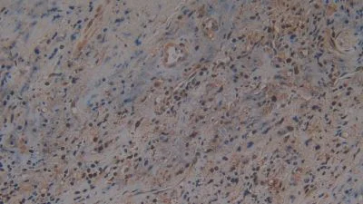 Immunohistochemistry (Formalin/PFA-fixed paraffin-embedded sections) - Anti-Hemojuvelin antibody [A7] (AB239492)