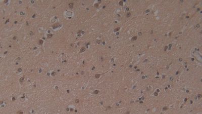 Immunohistochemistry (Formalin/PFA-fixed paraffin-embedded sections) - Anti-Hemojuvelin antibody [A7] (AB239492)