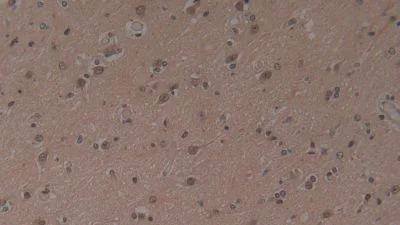 Immunohistochemistry (Formalin/PFA-fixed paraffin-embedded sections) - Anti-Hemojuvelin antibody [A7] (AB239492)