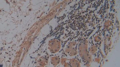Immunohistochemistry (Formalin/PFA-fixed paraffin-embedded sections) - Anti-Hemojuvelin antibody [A7] (AB239492)