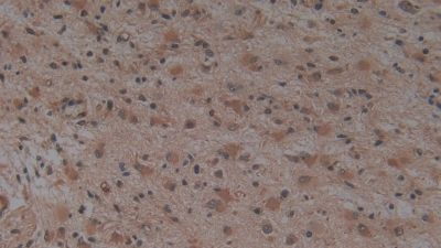 Immunohistochemistry (Formalin/PFA-fixed paraffin-embedded sections) - Anti-Hemojuvelin antibody [A7] (AB239492)
