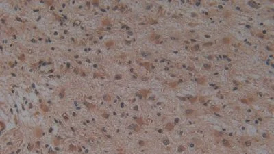 Immunohistochemistry (Formalin/PFA-fixed paraffin-embedded sections) - Anti-Hemojuvelin antibody [A7] (AB239492)