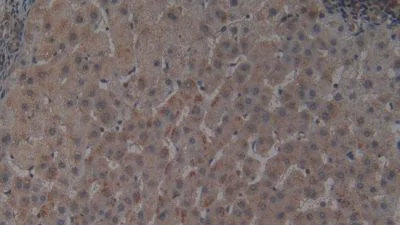 Immunohistochemistry (Formalin/PFA-fixed paraffin-embedded sections) - Anti-Hemojuvelin antibody [A7] (AB239492)