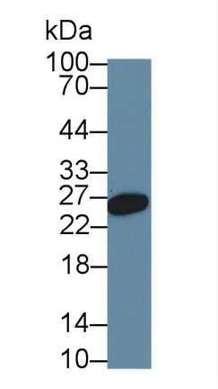 Western blot - Anti-Hemojuvelin antibody [A7] (AB239492)