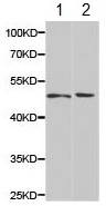 Western blot - Anti-Hemojuvelin antibody (AB187529)