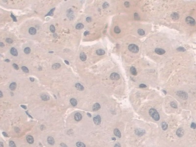 Immunohistochemistry (Formalin/PFA-fixed paraffin-embedded sections) - Anti-Hemojuvelin antibody [C1] (AB239591), expandable thumbnail
