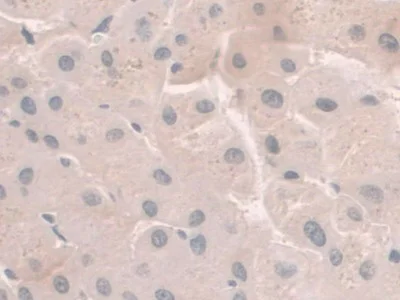 Immunohistochemistry (Formalin/PFA-fixed paraffin-embedded sections) - Anti-Hemojuvelin antibody [C1] (AB239591)