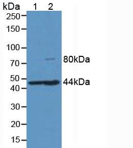 Western blot - Anti-Hemojuvelin antibody [C1] (AB239591), expandable thumbnail