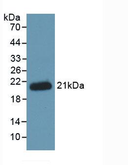 Western blot - Anti-Hemojuvelin antibody [C1] (AB239591), expandable thumbnail