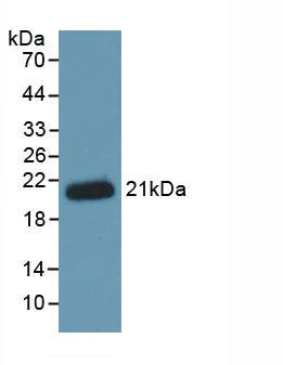 Western blot - Anti-Hemojuvelin antibody [C1] (AB239591)