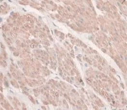 Immunohistochemistry (Formalin/PFA-fixed paraffin-embedded sections) - Anti-Hemojuvelin antibody [C6] (AB239495)