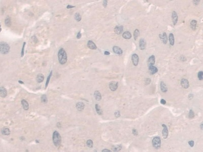 Immunohistochemistry (Formalin/PFA-fixed paraffin-embedded sections) - Anti-Hemojuvelin antibody [C6] (AB239495)