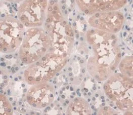 Immunohistochemistry (Formalin/PFA-fixed paraffin-embedded sections) - Anti-Hemojuvelin antibody [C6] (AB239495)