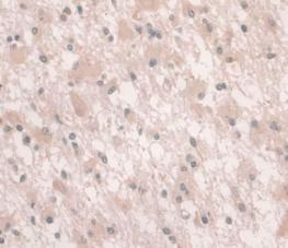 Immunohistochemistry (Formalin/PFA-fixed paraffin-embedded sections) - Anti-Hemojuvelin antibody [C6] (AB239495)