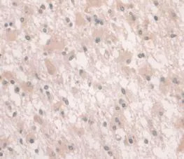 Immunohistochemistry (Formalin/PFA-fixed paraffin-embedded sections) - Anti-Hemojuvelin antibody [C6] (AB239495)
